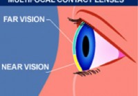 Multifocal-contact-lenses